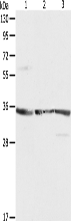 Anti-Human/Mouse/Rat RPLP0 Antibody - ABMIUM