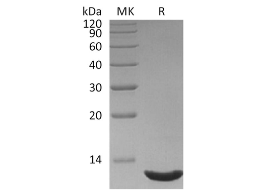 Recombinant Human CXCL12/SDF-1 Protein (aa19-93) - ABMIUM