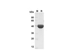 SDS-PAGE analysis of Mouse Chitinase 3-like 1 proteins , 2 μg/lane of Recombinant Mouse Chitinase 3-like 1 proteins was resolved with SDS-PAGE under reducing conditions , showing bands at 40 kDa.