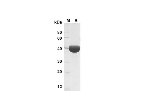 SDS-PAGE analysis of Mouse Chitinase 3-like 1 proteins , 2 μg/lane of Recombinant Mouse Chitinase 3-like 1 proteins was resolved with SDS-PAGE under reducing conditions , showing bands at 40 kDa.
