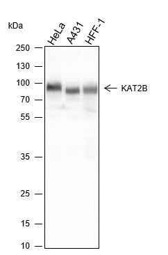 Anti-Human PCAF Antibody [A271] - ABMIUM