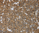 Anti-Human/Mouse PTPRM Antibody - ABMIUM