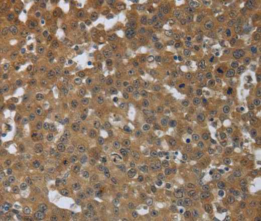 Anti-Human/Mouse PTPRM Antibody
