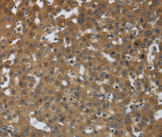 Anti-Human/Mouse PTPRM Antibody - ABMIUM