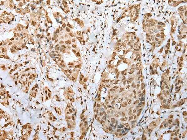 Anti-Human ZNF486 Antibody