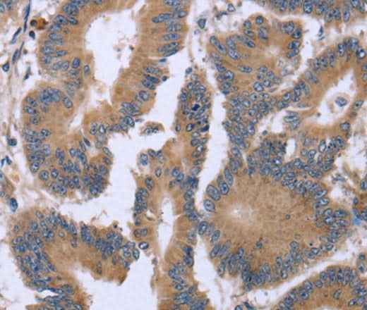 Anti-Human/Mouse KIAA1324 Antibody