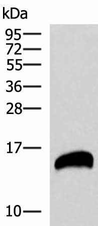 Anti-Human REG1B Antibody