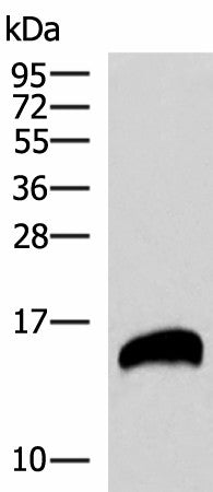 Western blot analysis of Human pancreas tissues lysate using REG1B Polyclonal Antibody at dilution of 1:800