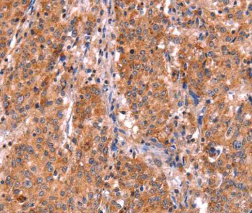 Anti-Human/Mouse/Rat ABI1 Antibody