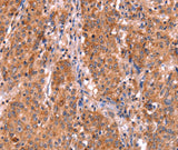 Anti-Human/Mouse/Rat ABI1 Antibody - ABMIUM