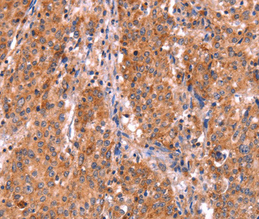 Anti-Human/Mouse/Rat ABI1 Antibody - ABMIUM