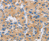 Anti-Human/Mouse DKK2 Antibody - ABMIUM