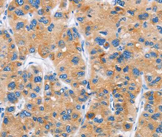 Anti-Human/Mouse DKK2 Antibody