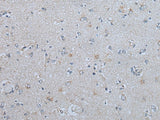 Immunohistochemistry of paraffin-embedded Human brain tissue using CENPF Polyclonal Antibody at dilution of 1:60(×200)