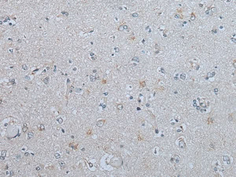 Immunohistochemistry of paraffin-embedded Human brain tissue using CENPF Polyclonal Antibody at dilution of 1:60(×200)
