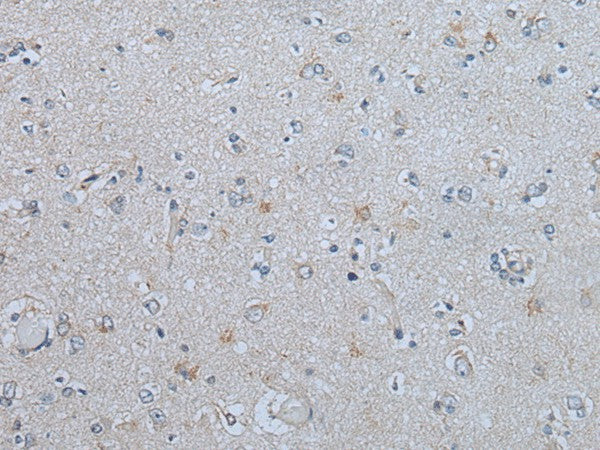 Immunohistochemistry of paraffin-embedded Human brain tissue using CENPF Polyclonal Antibody at dilution of 1:60(×200)