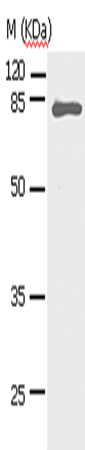 Anti-Human/Mouse/Rat STAT5A Antibody - ABMIUM