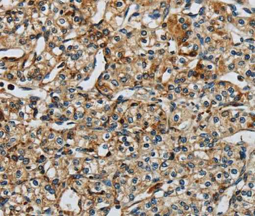 Anti-Human/Mouse/Rat EIF2AK3 Antibody