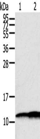 Anti-Human/Mouse/Rat S100A11 Antibody - ABMIUM
