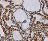 Anti-Human/Mouse CMC4 Antibody - ABMIUM