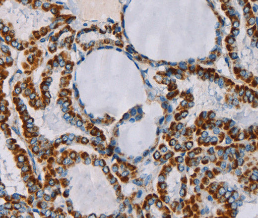 Anti-Human/Mouse CMC4 Antibody - ABMIUM