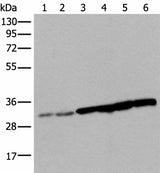 Western blot analysis of 293T cell Hela cell HEPG2 cell and A549 cell lysates using SNRPA Polyclonal Antibody at dilution of 1:250