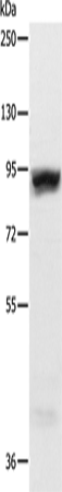 Anti-Human/Mouse RRM1 Antibody - ABMIUM