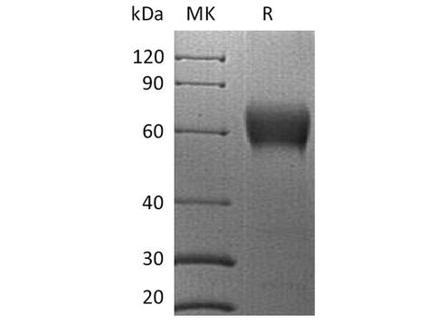 Recombinant Human B7-H5/Gi24/VSIR Protein (mFc Tag) - ABMIUM