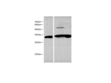 Anti-Human/Mouse/Rat EPO Antibody - ABMIUM