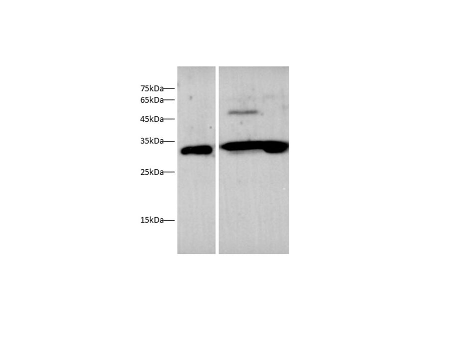 Anti-Human/Mouse/Rat EPO Antibody - ABMIUM