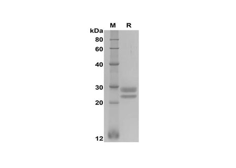 SDS-PAGE analysis of Human TNFSF18 proteins, 2 μg/lane of Recombinant Human TNFSF18 proteins was resolved with SDS-PAGE under reducing conditions, showing bands at 25-30 kDa.