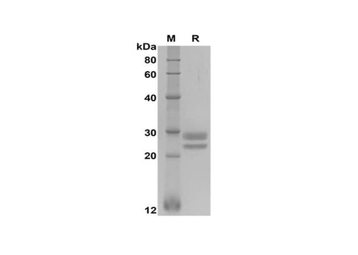 SDS-PAGE analysis of Human TNFSF18 proteins, 2 μg/lane of Recombinant Human TNFSF18 proteins was resolved with SDS-PAGE under reducing conditions, showing bands at 25-30 kDa.