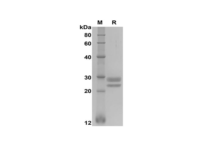 SDS-PAGE analysis of Human TNFSF18 proteins, 2 μg/lane of Recombinant Human TNFSF18 proteins was resolved with SDS-PAGE under reducing conditions, showing bands at 25-30 kDa.