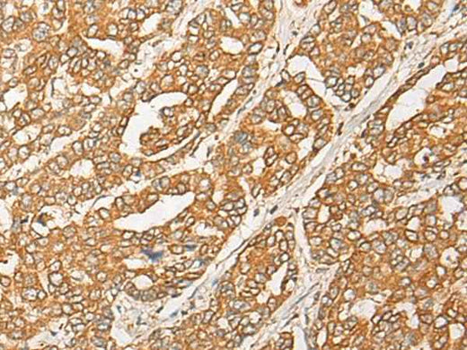 Anti-Human/Mouse GNB1L Antibody