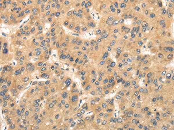 Anti-Human/Mouse TTC23 Antibody
