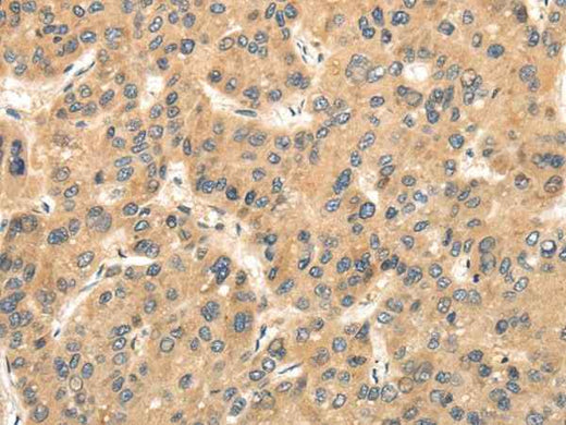 Anti-Human/Mouse TTC23 Antibody