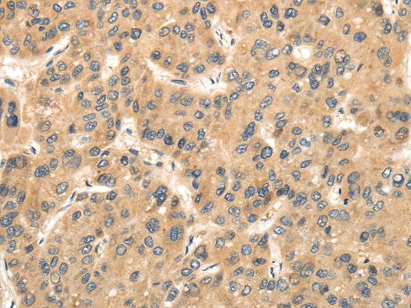 Anti-Human/Mouse TTC23 Antibody - ABMIUM