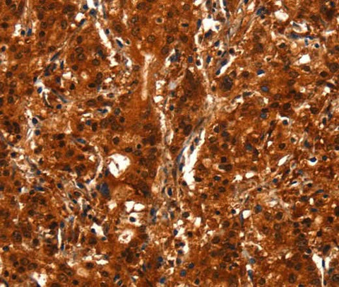 Anti-Human/Mouse BCAS3 Antibody - ABMIUM