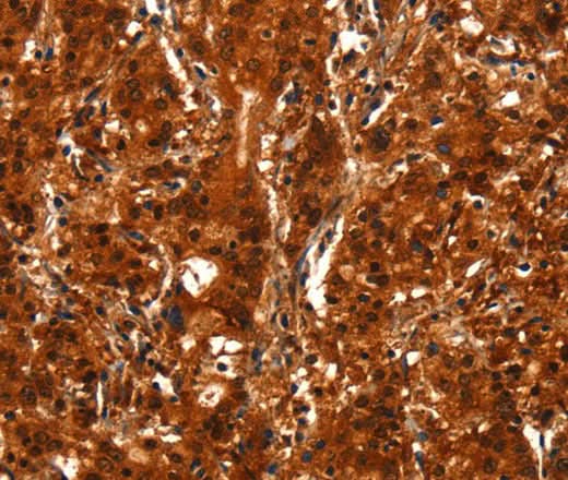 Anti-Human/Mouse BCAS3 Antibody - ABMIUM