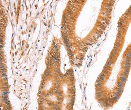 Anti-Human/Mouse/Rat TAX1BP1 Antibody