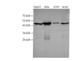 Anti-Human/Mouse CK-18 Antibody - ABMIUM