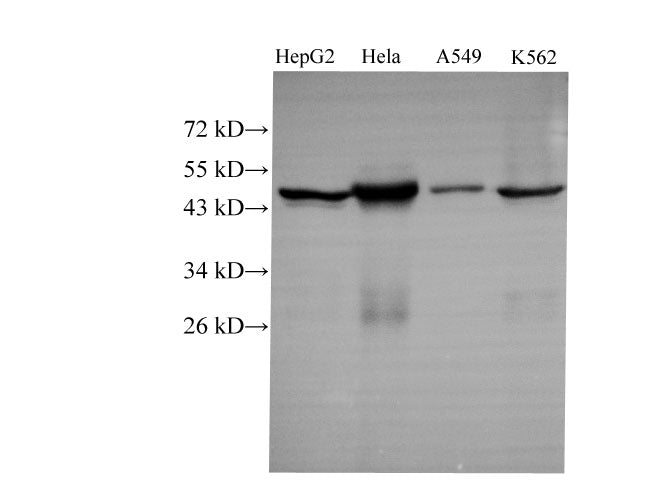 Anti-Human/Mouse CK-18 Antibody - ABMIUM