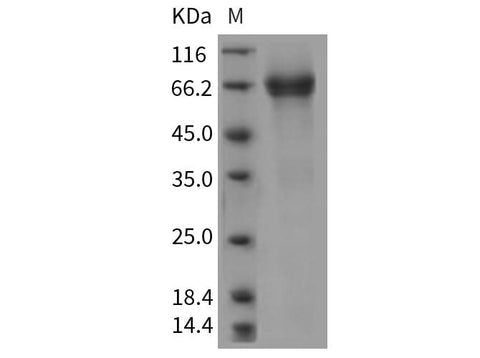 Recombinant Rat IL7RA/CD127 Protein (Fc Tag) - ABMIUM