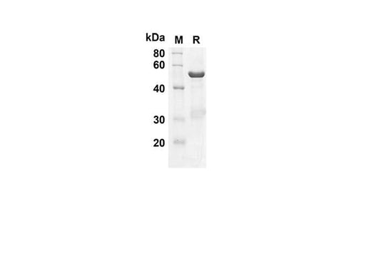 SDS-PAGE analysis of Human CNTF proteins, 2 μg/lane of Recombinant Human CNTF proteins was resolved with SDS-PAGE under reducing conditions, showing bands at 47.9 kDa.