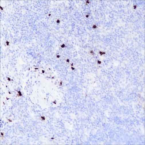 Anti-Human TPSAB1 Antibody [A381] - ABMIUM
