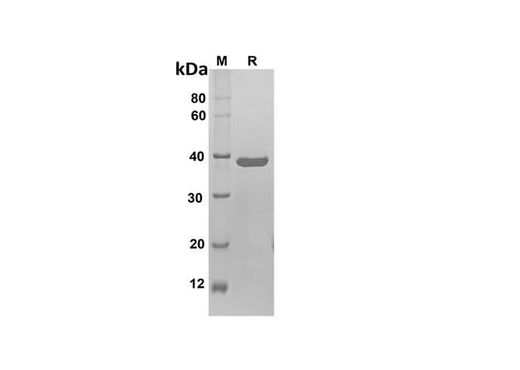 SDS-PAGE analysis of Human BCL2 proteins, 2 μg/lane of Recombinant Human BCL2 proteins was resolved with SDS-PAGE under reducing conditions, showing bands at 38 kDa.