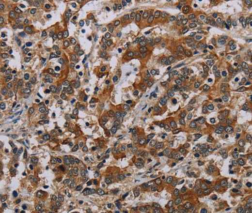 Anti-Human NLRP9 Antibody