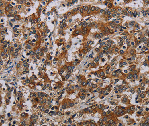 Anti-Human NLRP9 Antibody - ABMIUM