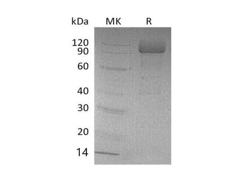 Recombinant Mouse SCARB2/LIMPII Protein (His Tag) - ABMIUM