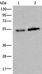 Western blot analysis of Human fetal intestines tissue and Human breast cancer tissue lysates using CCDC85C Polyclonal Antibody at dilution of 1:400